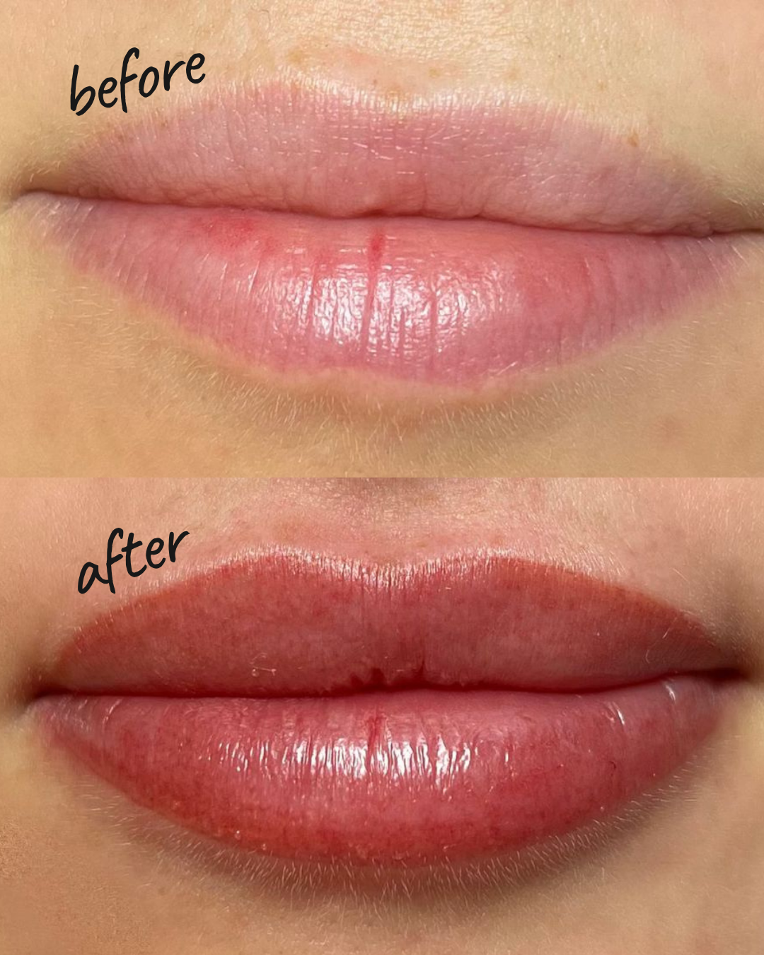 Lips Aquarelle Permanent Makeup NYC — Before and After